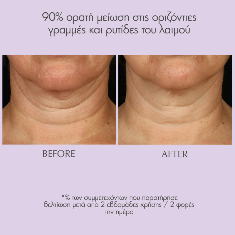 Exuviance Age Reverse+ Toning Neck Cream 125g