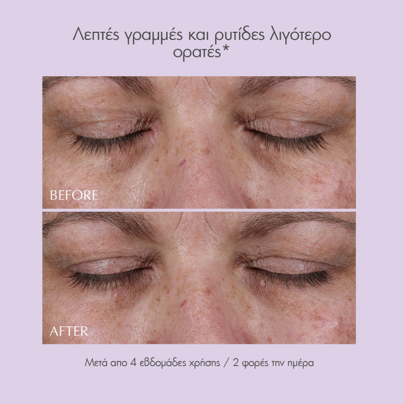 Exuviance Age Reverse Total 360 Eye Contour 15g