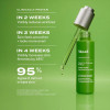 Murad Retinol Youth Renewal Oil Drops Αντιρυτιδικό Λάδι Προσώπου 30 ml