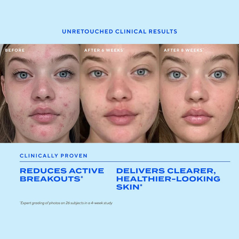 Murad Biome-Balancing Clear & Prevent Blemish Treatment Serum Προσώπου 30 ml