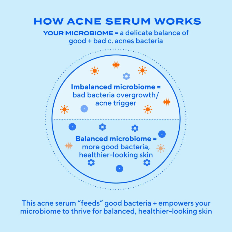Murad Biome-Balancing Clear & Prevent Blemish Treatment Serum Προσώπου 30 ml