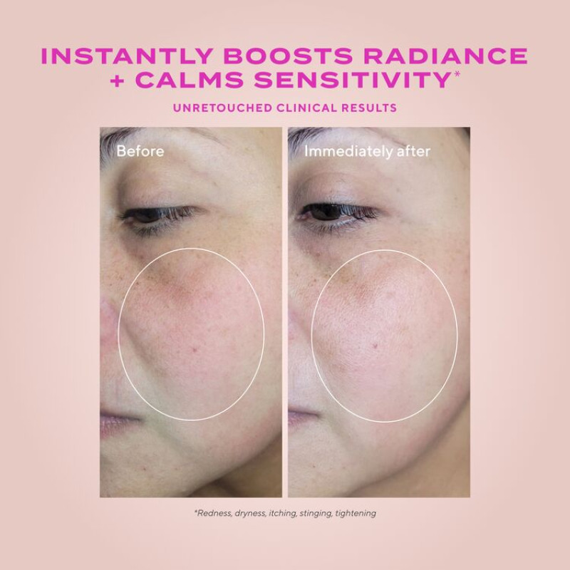 Heartleaf Gentle Resurfacing Serum για ευαίσθητο δέρμα