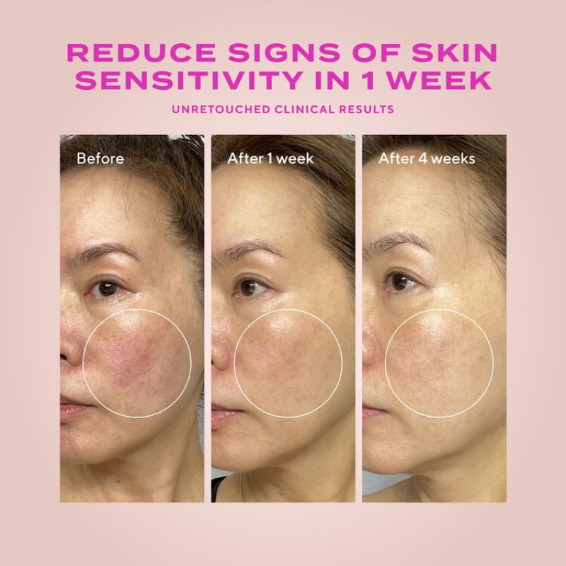 Heartleaf Gentle Resurfacing Serum για ευαίσθητο δέρμα