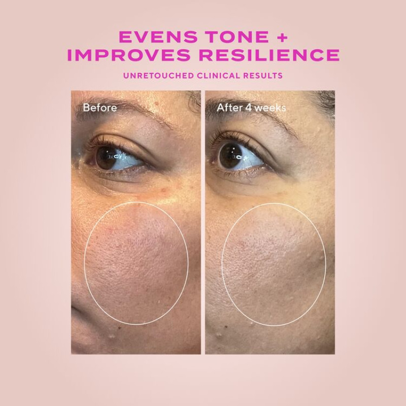 Heartleaf Gentle Resurfacing Serum για ευαίσθητο δέρμα