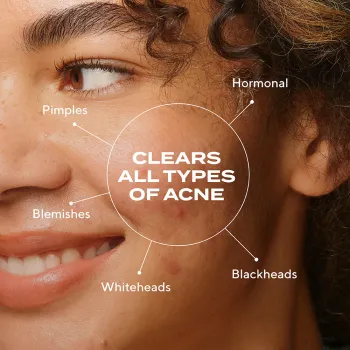 Bio-Balancing Clear & Prevent Blemish Treatment Serum Bio-Balancing Clear & Prevent Blemish Treatment Serum