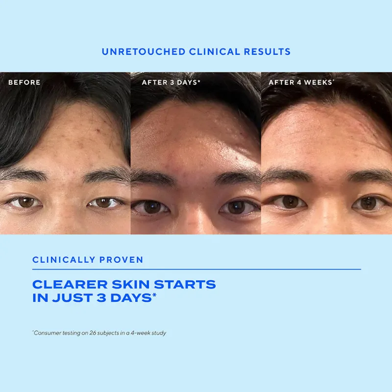 Murad Bio-Balancing Clear & Prevent Blemish Serum μπουκάλι